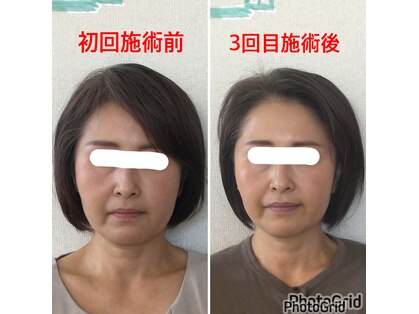 小顔矯正サロン ぷてぃらっくの写真
