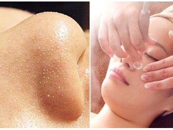 ビュップ 渋谷店(美up)の写真/【毛穴レス透明肌コース50分 ¥3300】50代からの美肌習慣◎肌状態を見極めた施術で感動の素肌へ♪