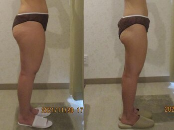 プロラボスパ 姫路店/20代後半 症例写真