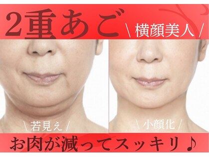 ミーティア(Meteor)の写真