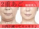 ミーティア(Meteor)の写真