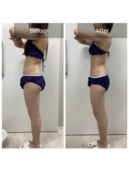 ダリア(Dahlia)/全身スペシャルデトックス