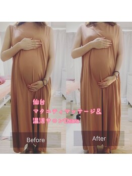 キアラ(Chiara)/マタニティ・ビフォーアフター