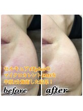 ナオ鍼灸院(Nao鍼灸院)/リフトアップはお任せ下さい！