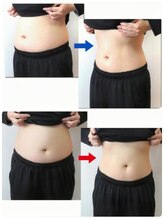 ルアナ(Luana)/美容業界で話題の脂肪冷却♪