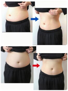 ルアナ(Luana)/美容業界で話題の脂肪冷却♪