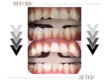 ムーウ(MuuU)の写真