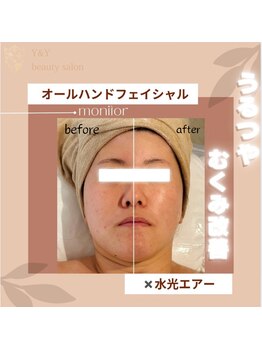 ワイアンドワイ(Y&Y)/むくみ改善で小顔効果/美肌/平塚