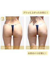 キングスサロン 熊本/足もほっそり！