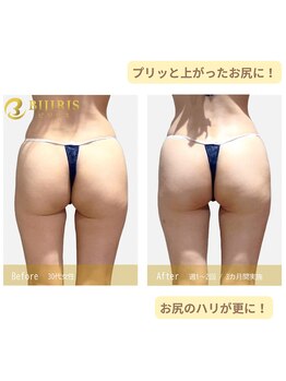 キングスサロン 熊本/足もほっそり！