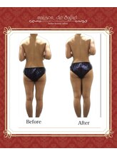 メゾン ド サファリ(maison de Safari)/30代／O脚・ストレートネック