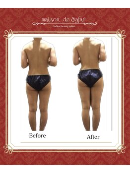 メゾン ド サファリ(maison de Safari)/30代/O脚・ストレートネック