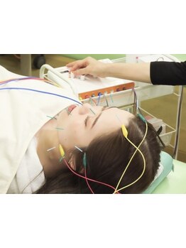 小顔になりたい