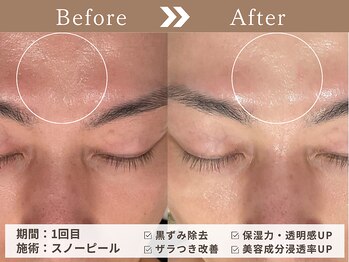 ファッショニスタ 恵比寿東口(Fashionista)/スノーピール/トーンアップ