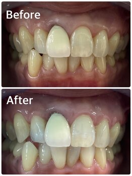 プラチナムビューティー 横須賀店/ビフォーアフター