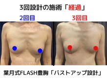 セブンシーズ 上野店(Seven Seas)/バストアップ/豊胸/東京都/上野