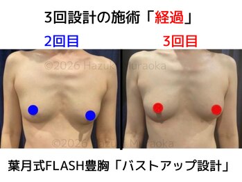 セブンシーズ 上野店(Seven Seas)/バストアップ/豊胸/東京都/上野