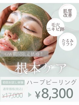 サロンドボーテアリス (Salon de beaute ALICE)の写真/【ニキビケアプログラム】ヴェルナハーブピーリング＋小顔筋膜リフト60分→¥9800たるみ・しみ・しわも改善