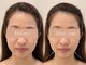 アトリエ コガオ(Atelier Kogao)の写真/【小顔矯正】施術実績2万人超・海外アワード受賞の実力派!歪み・エラ張りに1回でしっかりアプローチ◎