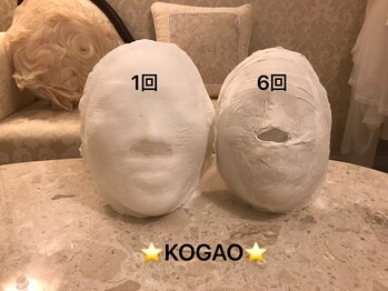 コガオ(KOGAO)/【効果実感】石膏パック×小顔