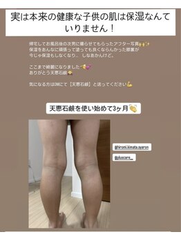 レクレア/頭から足の先まで皮膚1枚
