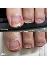 リリ(lili)/フットケア/ネイルスキンケア