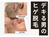 【デキる男のヒゲ脱毛】男の清潔感は肌で決まる！！プレミアムヒゲ脱毛☆彡