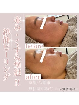 エイム(eim)/イラストリアス