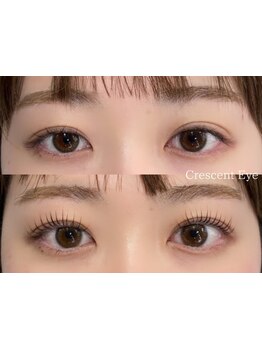 まつげのお悩み解決サロン