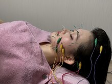 サロン ド ハリッシュ(Salon de HARISH)/立体造顔電気美容鍼　60本