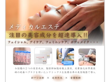 ルーナサロン(LUNA salon)の写真