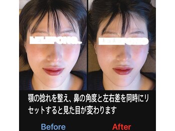 美容矯正サロン レレポノ(LELEPONO)/