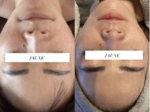 ジョーヌ(JAUNE)/