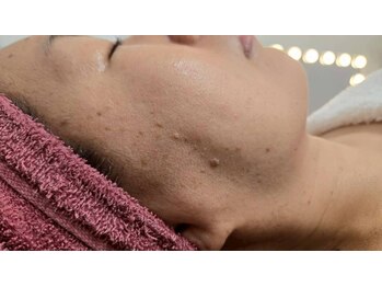 クレビア(CREBIA)/【シミ・シミケア専門店】沖縄県