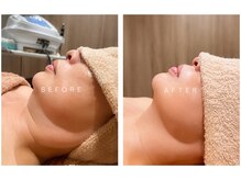 エル ボーテ(ELLE beaute)の雰囲気（約7回施術すると小顔に！！）