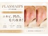 ニキビ・毛穴・凹凸!プラズマ×エクストリュージョン×限界濃度IPS美容液