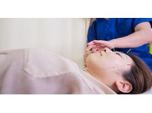かげやま鍼灸接骨院/お顔の鍼