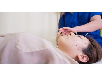 かげやま鍼灸接骨院/お顔の鍼