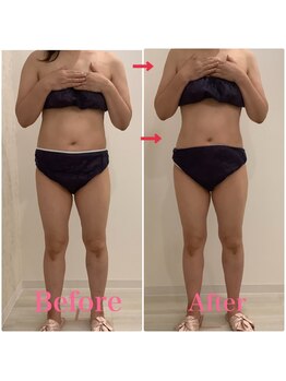 スペチアーレ 夙川/高額マシンを使ってサイズダウン