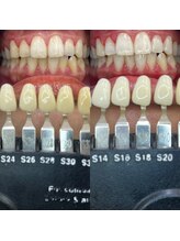 トウキョウスワーズ 池袋店(TOKYO SWRS)/#ホワイトニング #池袋 #渋谷