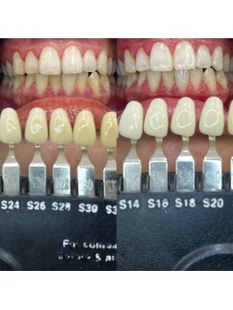 トウキョウスワーズ 池袋店(TOKYO SWRS)/#ホワイトニング #池袋 #渋谷