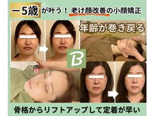 ベルソー(Berceau)