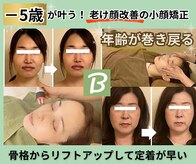ベルソー(Berceau)