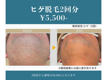 ビューティー サロン アズール(BEAUTY SALON AZUL)の写真