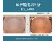 ビューティー サロン アズール(BEAUTY SALON AZUL)の写真