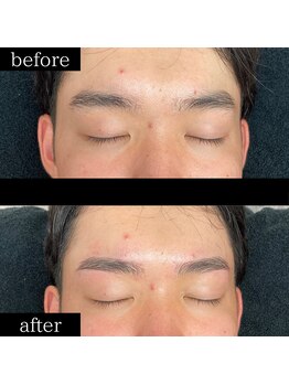 ユー 千葉駅前店(you)/メンズ眉毛/メンズ眉/千葉駅