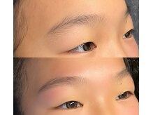 リリー(Lily)/【U24/アイブロウワックス脱毛】