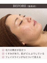 山参/ＢＥＦＯＲＥ