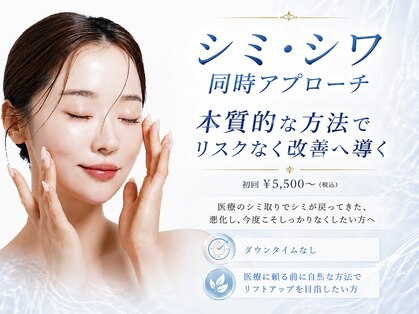 シャルナ(charna)の写真