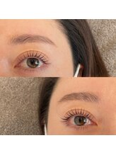 アイラッシュ ティル(eyelash till)/ラッシュリフト